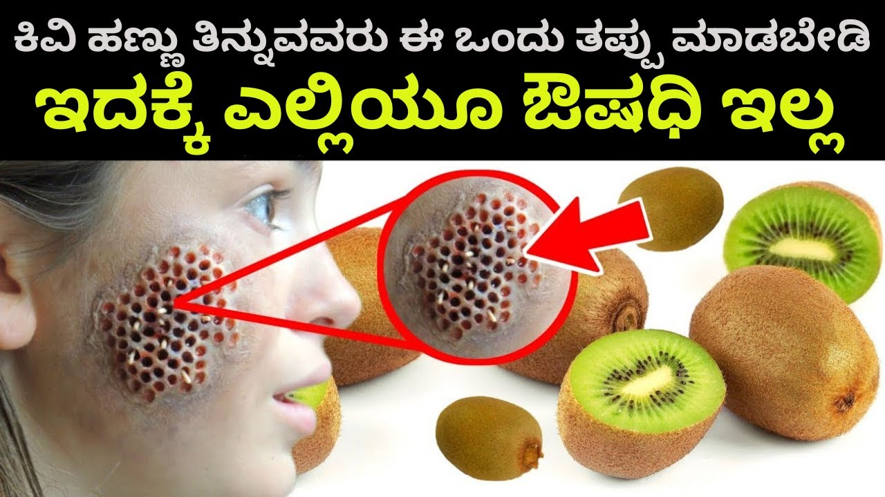 ಕಿವಿ ಹಣ್ಣು ತಿನ್ನುವವರು ಈ ಒಂದು ತಪ್ಪು ಮಾಡಬೇಡಿ.ಇದಕ್ಕೆ ಎಲ್ಲಿಯೂ ಔಷಧಿ ಇಲ್ಲ..ಯೋಚನೆ ಮಾಡಿ